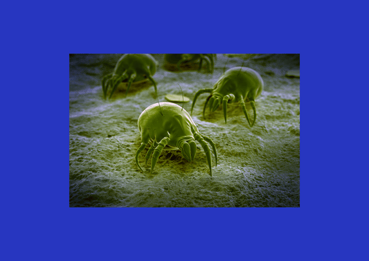 Dust Mite Allergies: The Hidden Culprits Lurking in Your Home - DuuDuu Mattress